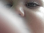 IM000417