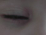 IM000418